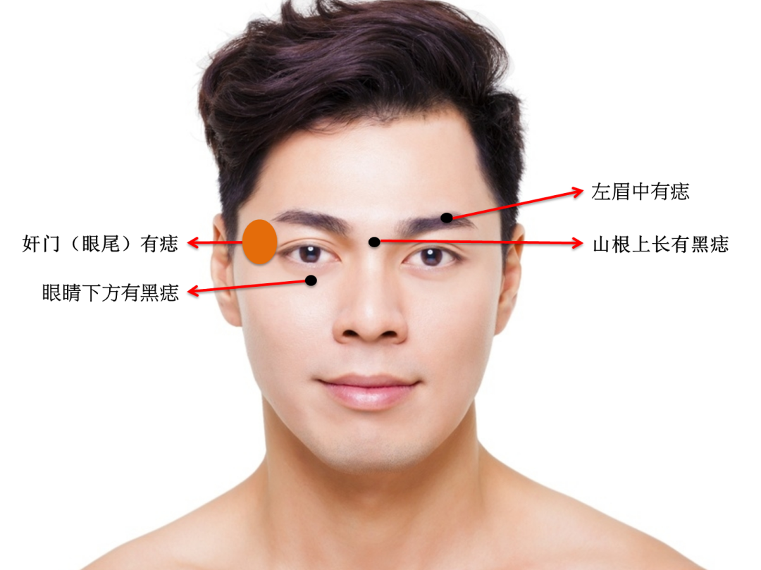 男人左眼角有痣代表图图片
